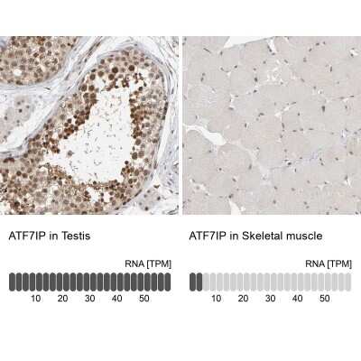 Immunohistochemistry-Paraffin: MCAF1 Antibody [NBP1-84610]