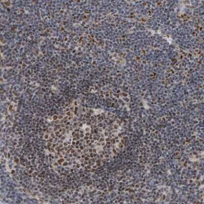 Immunohistochemistry-Paraffin: MCAF1 Antibody [NBP1-84610]