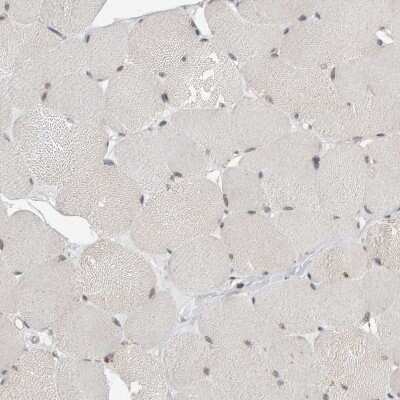 Immunohistochemistry-Paraffin: MCAF1 Antibody [NBP1-84610]