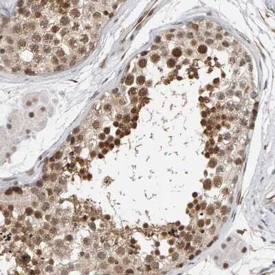 Immunohistochemistry-Paraffin: MCAF1 Antibody [NBP1-84610]