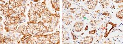 Immunohistochemistry-Paraffin: MCAM/CD146 Antibody (012) [NBP2-89202]