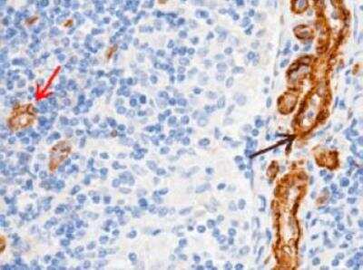 Immunohistochemistry-Paraffin: MCAM/CD146 Antibody (012) [NBP2-89202]