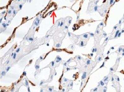 Immunohistochemistry-Paraffin: MCAM/CD146 Antibody (012) [NBP2-89202]