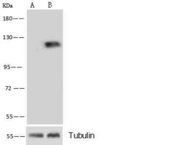 Western Blot: MCAM/CD146 Antibody (012) [NBP2-89202]