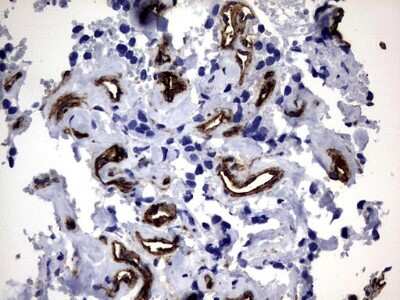 Immunohistochemistry: MCAM/CD146 Antibody (OTI5C4) [NBP2-45770]