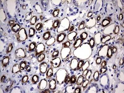 Immunohistochemistry: MCAM/CD146 Antibody (OTI5C4) [NBP2-45770]