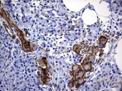 Immunohistochemistry: MCAM/CD146 Antibody (OTI5C4) [NBP2-45770]
