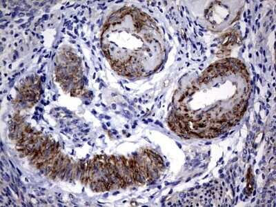 Immunohistochemistry: MCAM/CD146 Antibody (OTI5C4) [NBP2-45770]