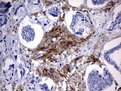 Immunohistochemistry: MCAM/CD146 Antibody (OTI5C4) [NBP2-45770]