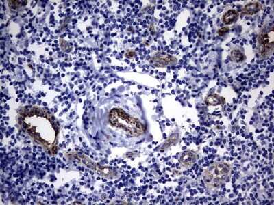 Immunohistochemistry: MCAM/CD146 Antibody (OTI5C4) [NBP2-45770]