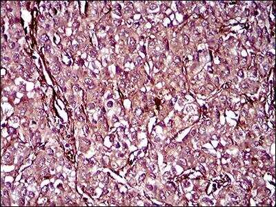 Immunohistochemistry-Paraffin: MCAM/CD146 Antibody (6C3E6) - BSA Free [NBP2-37365]