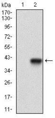 Western Blot: MCAM/CD146 Antibody (6C3E6)BSA Free [NBP2-37365]