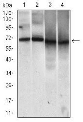 Western Blot: MCAM/CD146 Antibody (6C3E6)BSA Free [NBP2-37365]