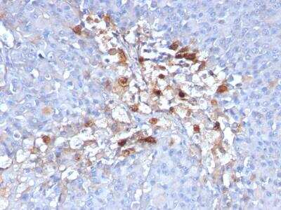 Immunohistochemistry-Paraffin: MCAM/CD146 Antibody (C146/634) - IHC-Prediluted [NBP2-48199]