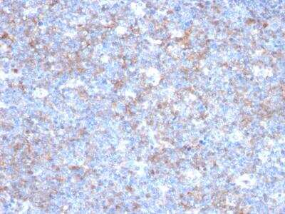 Immunohistochemistry-Paraffin: MCAM/CD146 Antibody (C146/634) - IHC-Prediluted [NBP2-48199]