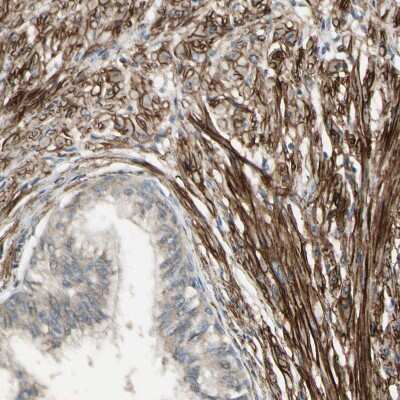 Immunohistochemistry-Paraffin: MCAM/CD146 Antibody [NBP1-88132]