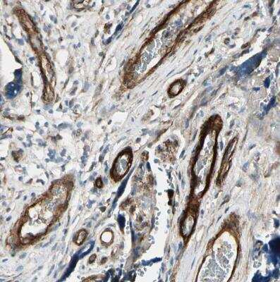 Immunohistochemistry-Paraffin: MCAM/CD146 Antibody [NBP1-88132]