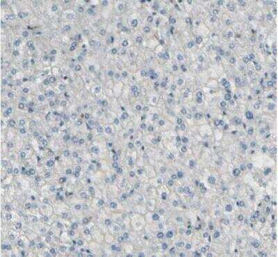 Immunohistochemistry-Paraffin: MCAM/CD146 Antibody [NBP1-88132]
