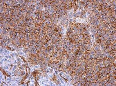Immunohistochemistry-Paraffin: MCAM/CD146 Antibody [NBP2-15778]