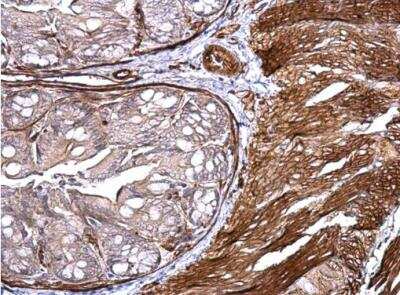 Immunohistochemistry-Paraffin: MCAM/CD146 Antibody [NBP2-15778]