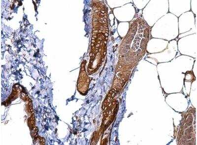 Immunohistochemistry-Paraffin: MCAM/CD146 Antibody [NBP2-15778]