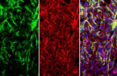 Immunohistochemistry-Paraffin: MCAM/CD146 Antibody [NBP2-15778]