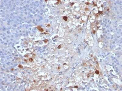 Immunohistochemistry-Paraffin: MCAM/CD146 Antibody (MCAM/1101) - Azide and BSA Free [NBP2-47776]