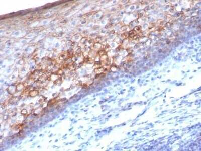 Immunohistochemistry-Paraffin: MCAM/CD146 Antibody (MCAM/1101) - IHC-Prediluted [NBP2-48166]