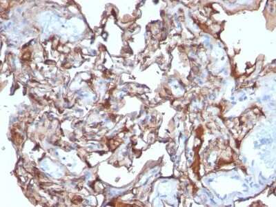 Immunohistochemistry-Paraffin: MCAM/CD146 Antibody (MCAM/1101) [NBP2-44509]