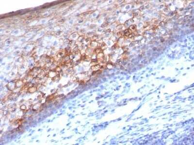 Immunohistochemistry-Paraffin: MCAM/CD146 Antibody (MCAM/1101) [NBP2-44509]