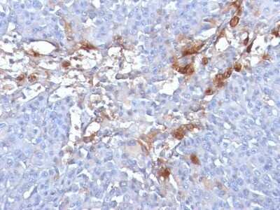 Immunohistochemistry-Paraffin: MCAM/CD146 Antibody (MUC18/1130) - Azide and BSA Free [NBP2-47777]