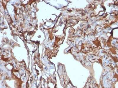 Immunohistochemistry-Paraffin: MCAM/CD146 Antibody (MUC18/1130) - Azide and BSA Free [NBP2-47777]