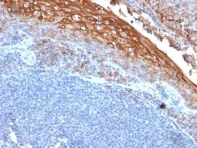 Immunohistochemistry-Paraffin: MCAM/CD146 Antibody (MUC18/1130) - Azide and BSA Free [NBP2-47777]