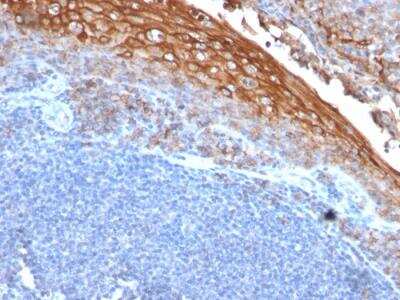 Immunohistochemistry-Paraffin: MCAM/CD146 Antibody (MUC18/1130) - IHC-Prediluted [NBP2-48207]