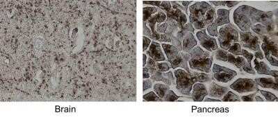 Immunohistochemistry-Paraffin: MCAM/CD146 Antibody (MUC18/1130) - IHC-Prediluted [NBP2-48207]