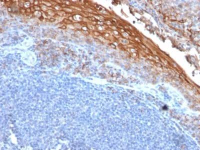 Immunohistochemistry-Paraffin: MCAM/CD146 Antibody (MUC18/1130) [NBP2-44512]