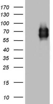 Western Blot: MCAM/CD146 Antibody (OTI5C4)Azide and BSA Free [NBP2-72595]