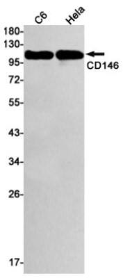 Western Blot: MCAM/CD146 Antibody (S05-5A2) [NBP3-19541]