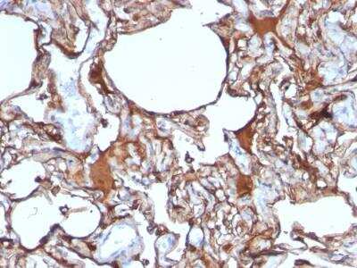 Immunohistochemistry-Paraffin: MCAM/CD146 Antibody (SPM620) - IHC-Prediluted [NBP2-48198]