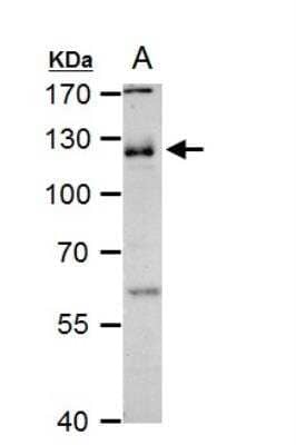 Western Blot: MCAM/CD146 Antibody [NBP2-15778]
