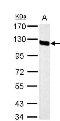 Western Blot: MCAM/CD146 Antibody [NBP2-15778]