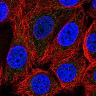 Immunocytochemistry/ Immunofluorescence: MCART1 Antibody [NBP2-55344]