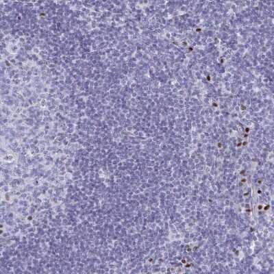 Immunohistochemistry-Paraffin: MCART1 Antibody [NBP2-46847]