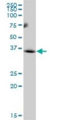 Western Blot: MCART1 Antibody [H00092014-B01P]