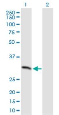 Western Blot: MCART1 Antibody [H00092014-B01P]