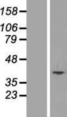 Western Blot: MCART1 Overexpression Lysate [NBL1-12942]