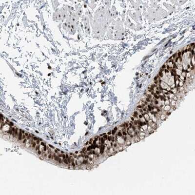 Immunohistochemistry-Paraffin: MCART6 Antibody [NBP1-91007]