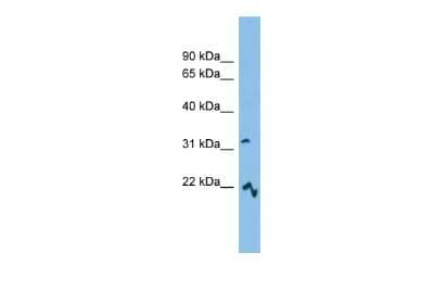 Western Blot: MCART6 Antibody [NBP2-83186]