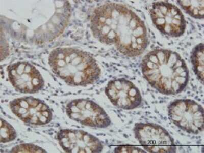 Immunohistochemistry-Paraffin: MCAT Antibody (2F2) [H00027349-M01]