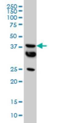 Western Blot: MCAT Antibody (2F2) [H00027349-M01]